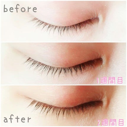 スカルプD ボーテ ピュアフリーアイラッシュセラム プレミアム/アンファー(スカルプD)/まつげ美容液を使ったクチコミ(3枚目)