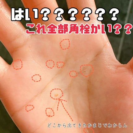デュオ ザ 薬用クレンジングバーム バリア【医薬部外品】/DUO/クレンジングバームを使ったクチコミ(3枚目)