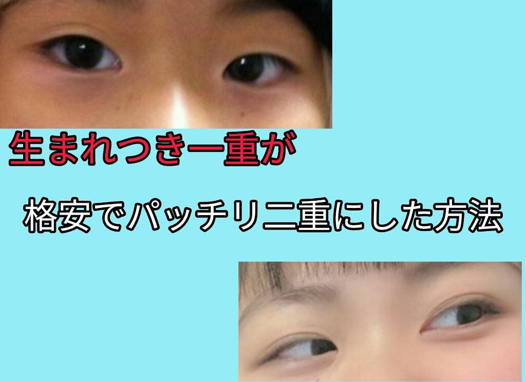 マンネ。 on LIPS 「こんにちわ!!マンネでーーす。マンネ実は一重ぶすだったんです。..」(1枚目)