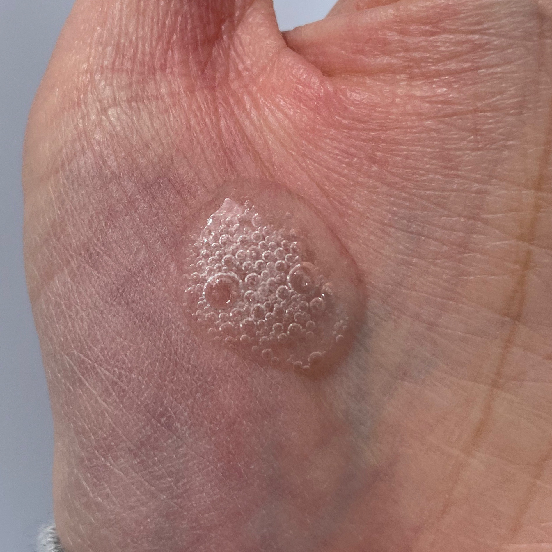 Cセラム/CVITAS/美容液を使ったクチコミ（2枚目）