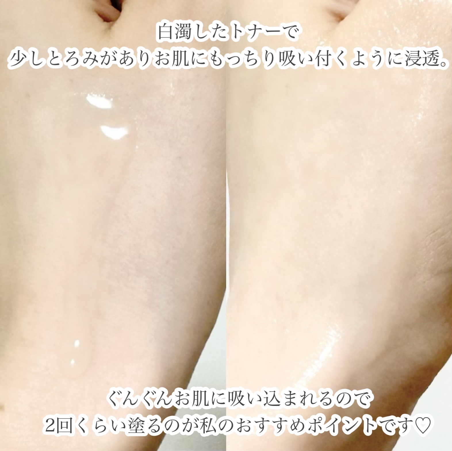 エクストリームエッセンストナーオリジナル/Real Barrier/化粧水を使ったクチコミ（3枚目）