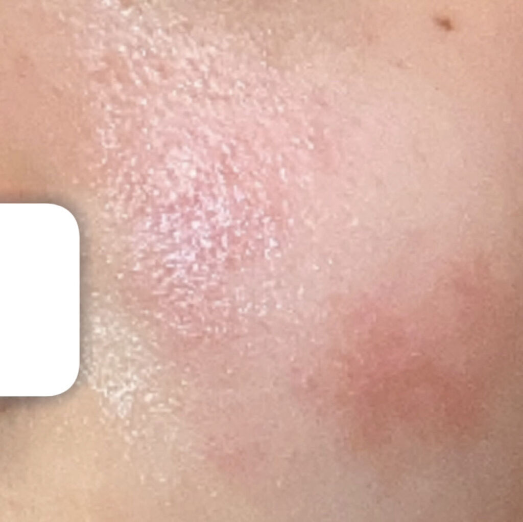 乳液・敏感肌用・さっぱりタイプ/無印良品/乳液を使ったクチコミ（3枚目）