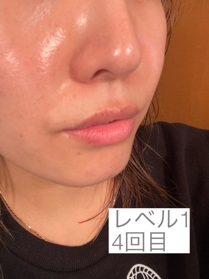 ダーマエアショット / MEDICUBEの口コミ | おすすめ順 | 235件 ダーマエアショット / MEDICUBEの口コミ | おすすめ順 | 235件