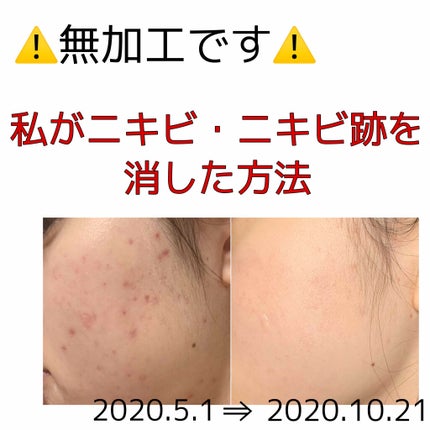化粧水・敏感肌用・高保湿タイプ/無印良品/化粧水を使ったクチコミ(1枚目)