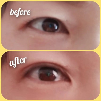 メザイク クリップ カッター ファイバー専用カッター/メザイク/二重まぶた用アイテムを使ったクチコミ(6枚目)