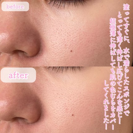 タトゥーウォータープルーフスカーコンシーラー/フォレンコス/リキッドコンシーラーを使ったクチコミ(4枚目)