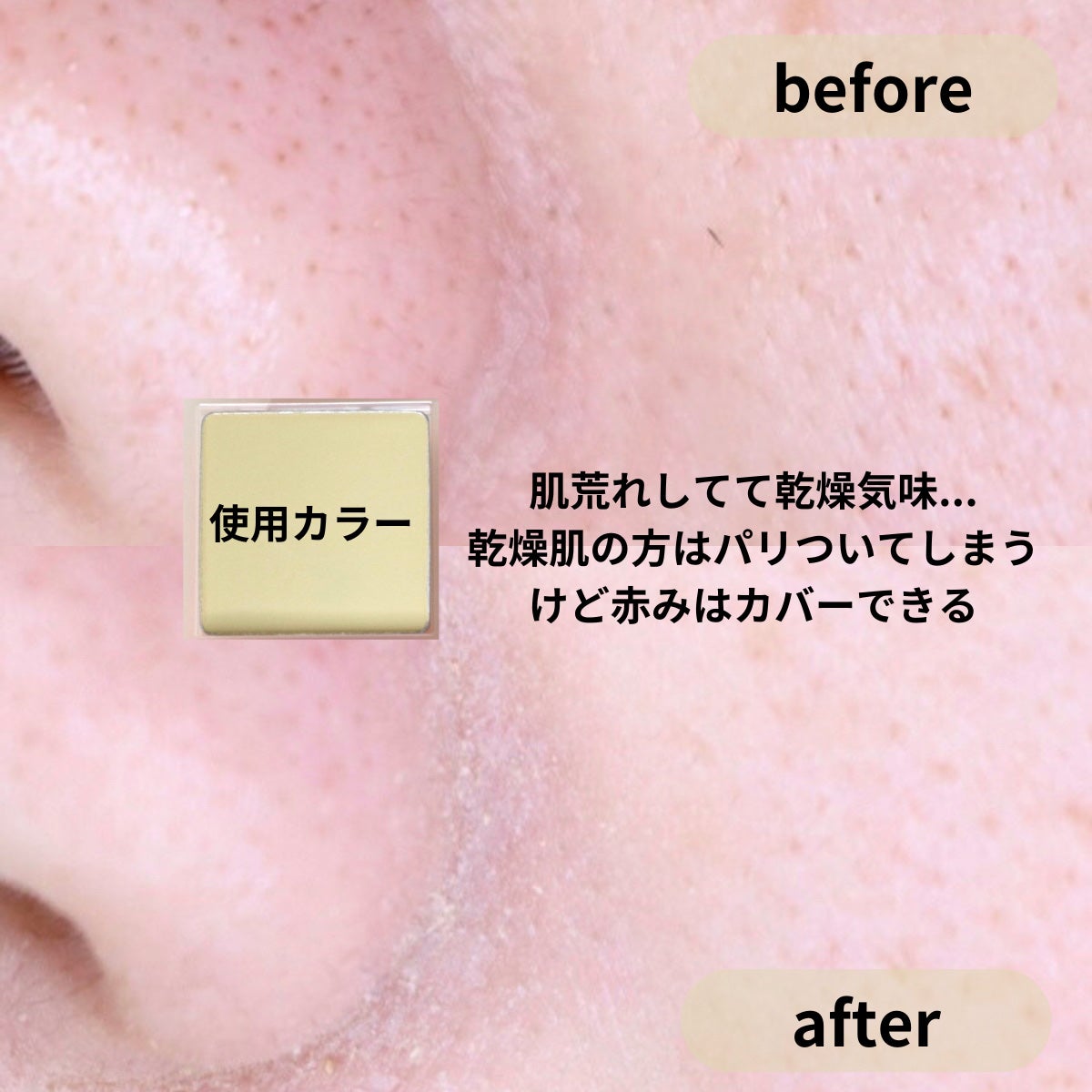 コンシールブレンダーパレット/LUNA/パレットコンシーラーを使ったクチコミ(6枚目)