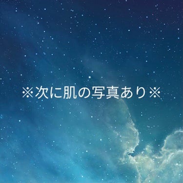 皆さんお久しぶりです、みおりです( ¨̮ )
数ヶ月前にアピューのシカクリームを使用した感想を後日投稿するとか言っておきながらしてませんでした💦
(正直効果がよくわからなくて……)

使い切ったあと1度