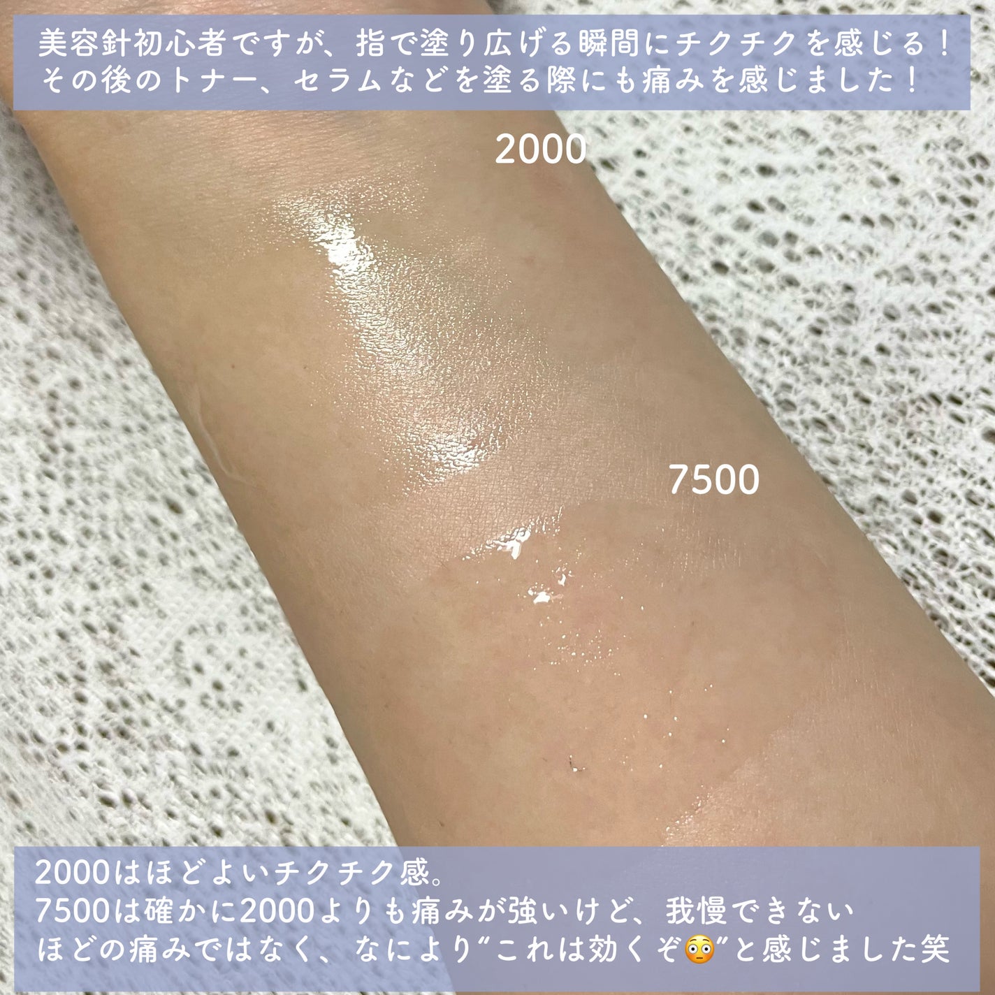 ゼロ1DAYエクソソームショット2000/MEDICUBE/美容液を使ったクチコミ(4枚目)