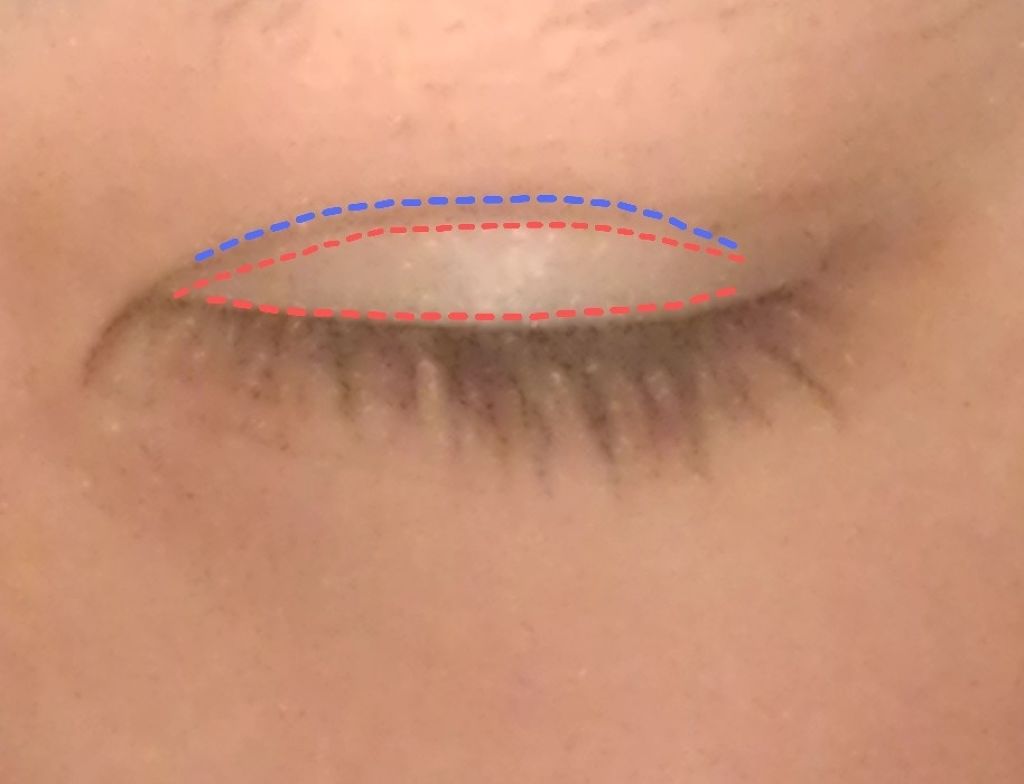 二重まぶた用シール/DAISO/二重まぶた用アイテムを使ったクチコミ(4枚目)