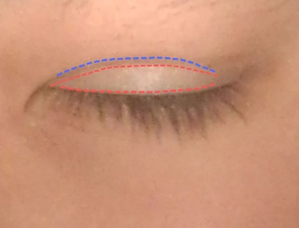 二重まぶた用シール/DAISO/二重まぶた用アイテムを使ったクチコミ(4枚目)