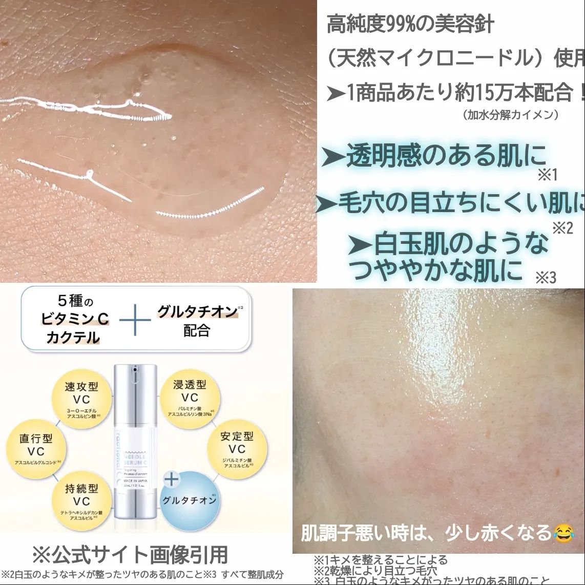 fractionalCC ニードルセラムC/fractionalCC/美容液を使ったクチコミ（2枚目）