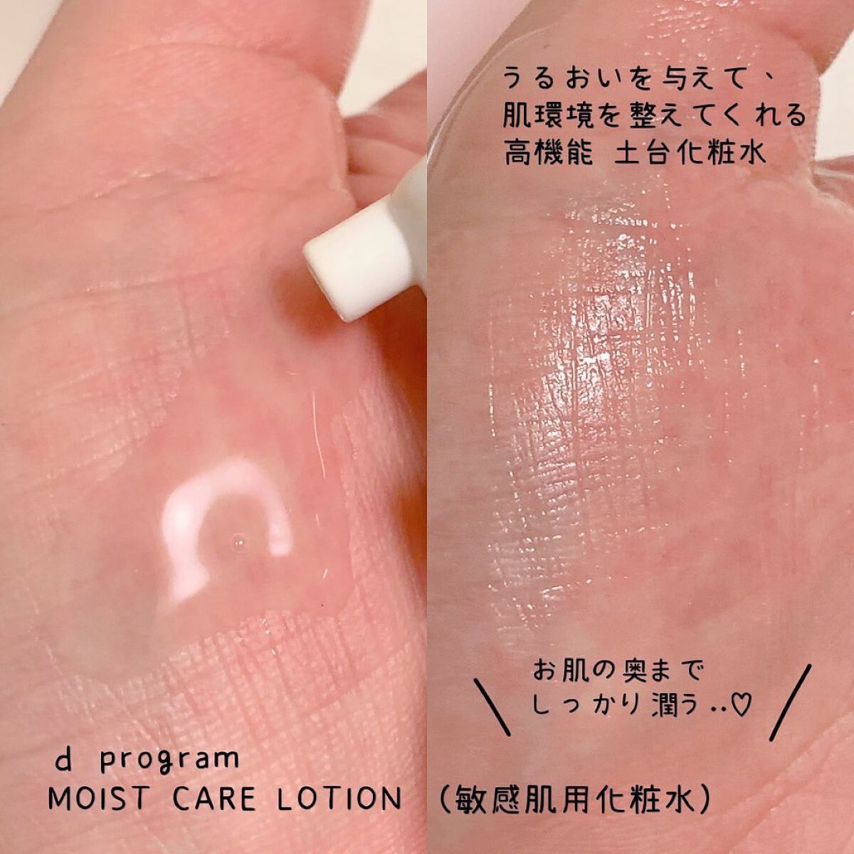 モイストケア ローション MB/d プログラム/化粧水を使ったクチコミ（2枚目）