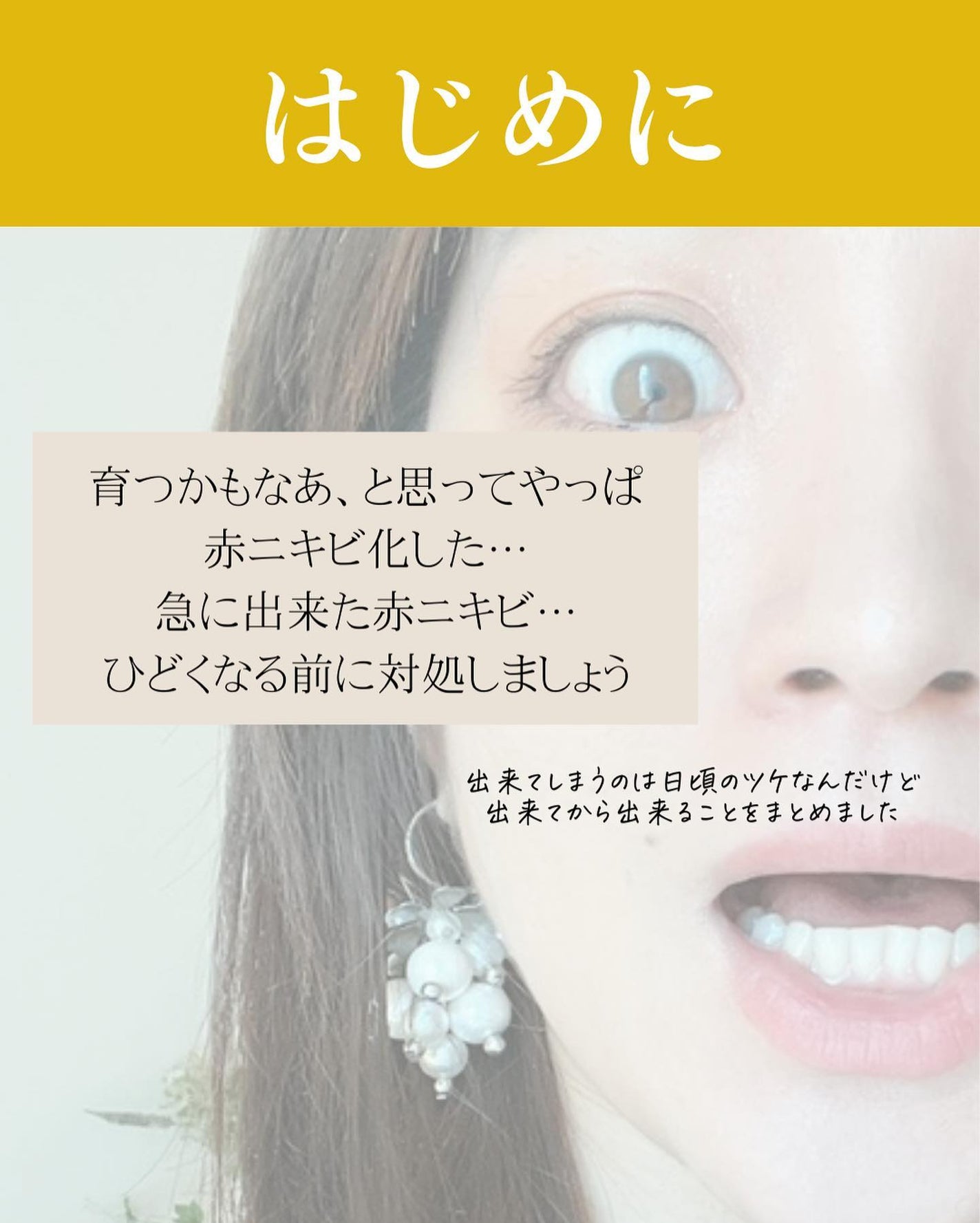 おゆみ|ニキビ・ニキビ跡ケア on LIPS 「@______ohyoume◀︎他の投稿はこちらから💄【ニキビ..」(2枚目)