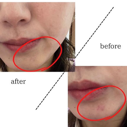 ソフトマットコンプリートコンシーラー/NARS/クリームコンシーラーを使ったクチコミ(3枚目)