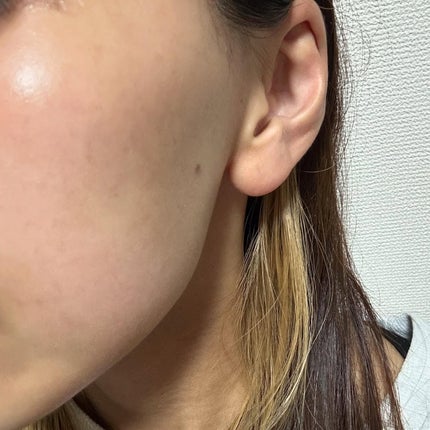 PDRNヒアルロン酸カプセル100セラム/Anua/美容液を使ったクチコミ(5枚目)