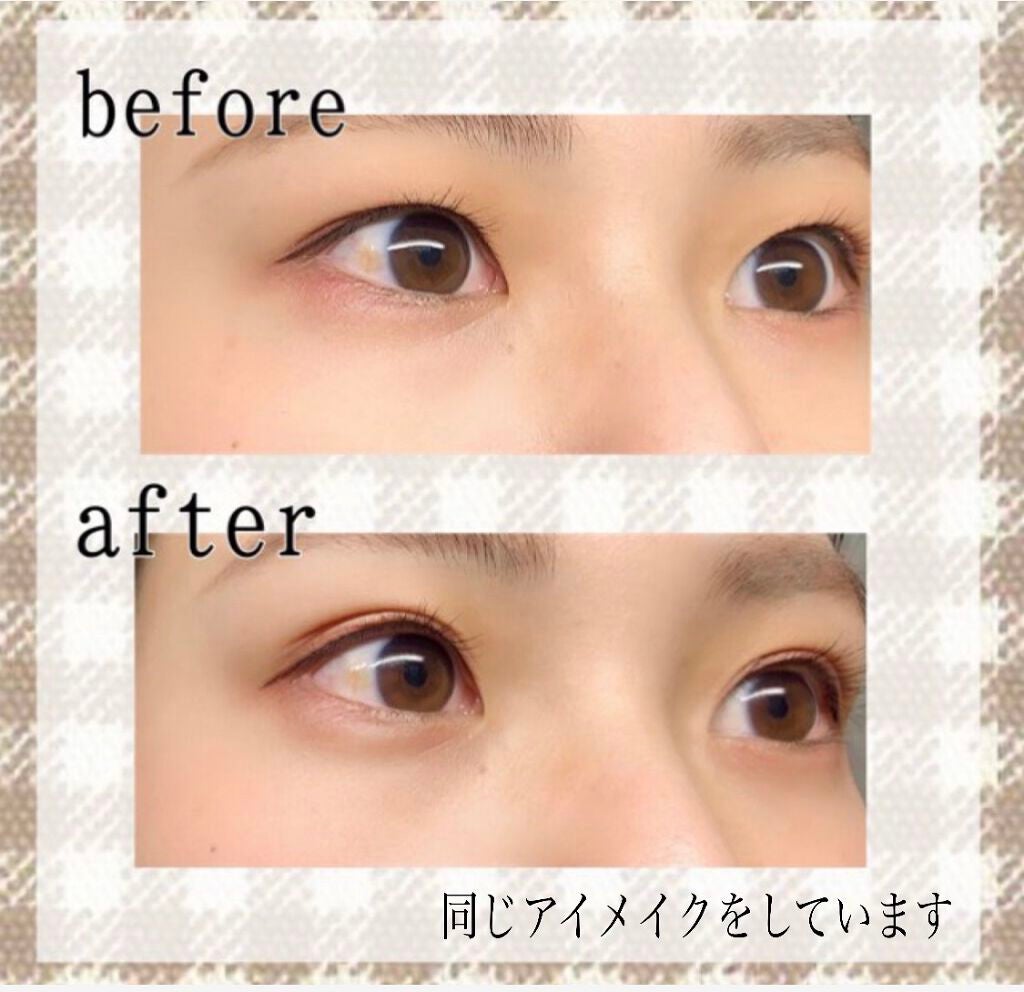 オリシキ アイリッドスキンフィルム /D-UP/二重まぶた用アイテムを使ったクチコミ(3枚目)