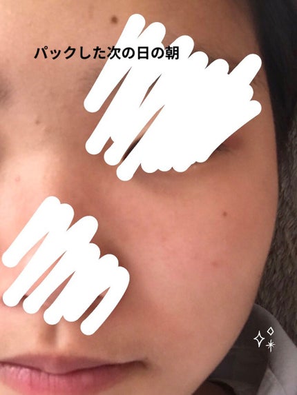 ティーツリーケア ソリューション エッセンシャルマスクEX/MEDIHEAL/シートマスク・パックを使ったクチコミ(2枚目)