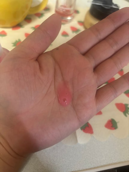 PDRNピンクアンプル PDRN 10,000ppm配合/MEDICUBE/美容液を使ったクチコミ(2枚目)