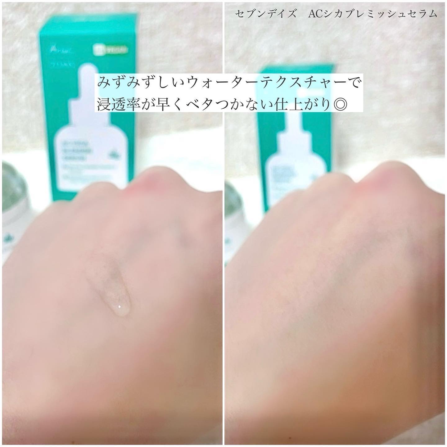 AC シカブレミッシュセラム/Ariul/美容液を使ったクチコミ（2枚目）