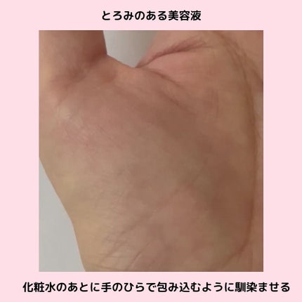 ピンクティーツリーシナジーセラム/APLIN/美容液を使ったクチコミ(4枚目)