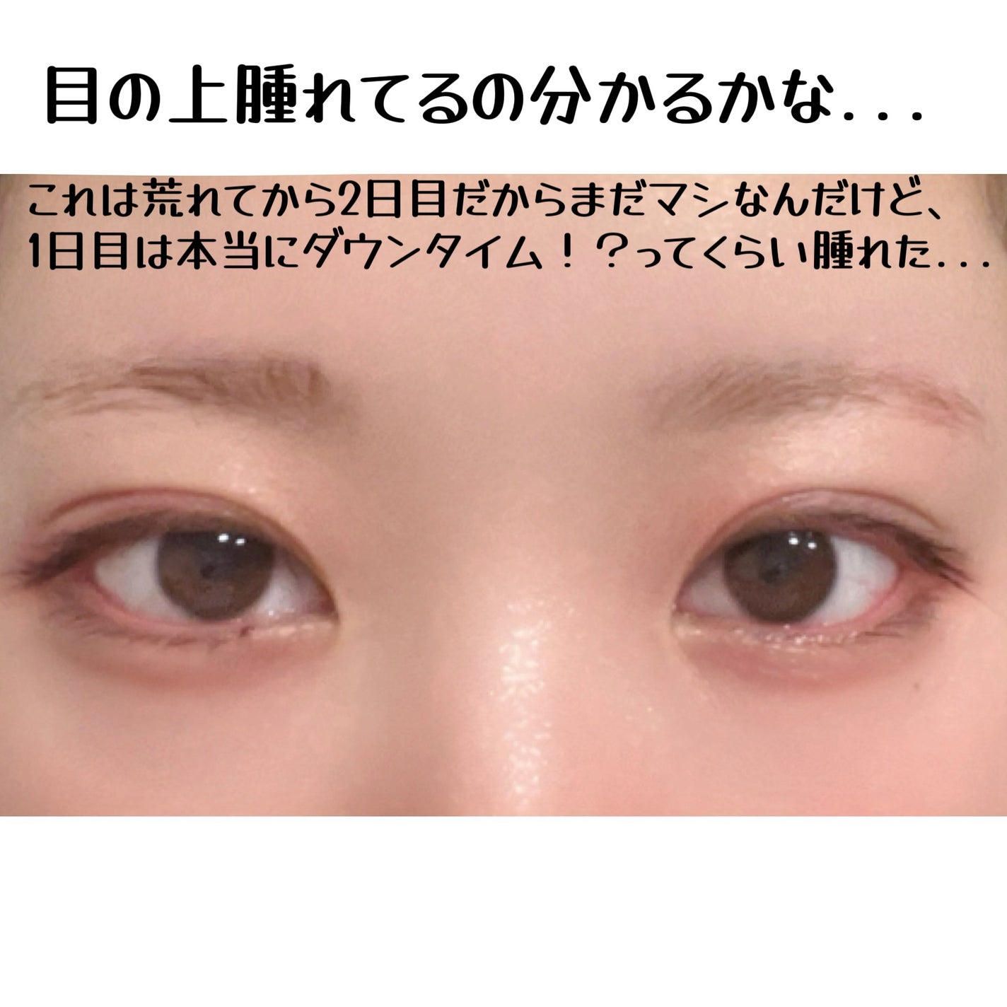 ルルルン ハイドラ EX マスク/ルルルン/シートマスク・パックを使ったクチコミ(3枚目)