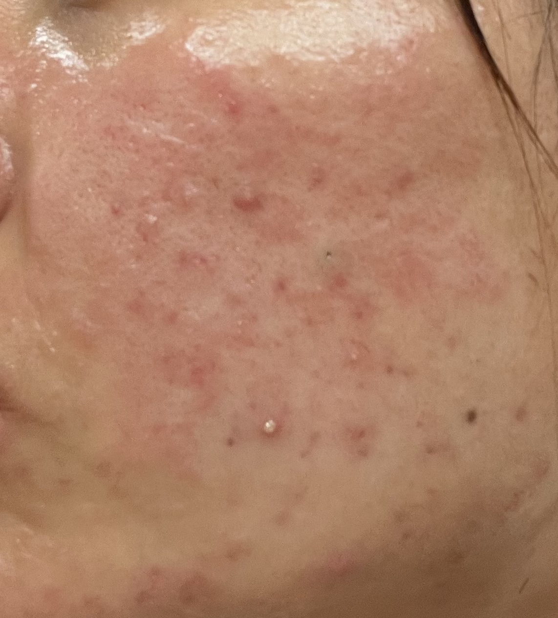 薬用ローション（とてもしっとり）/IHADA/化粧水を使ったクチコミ（1枚目）