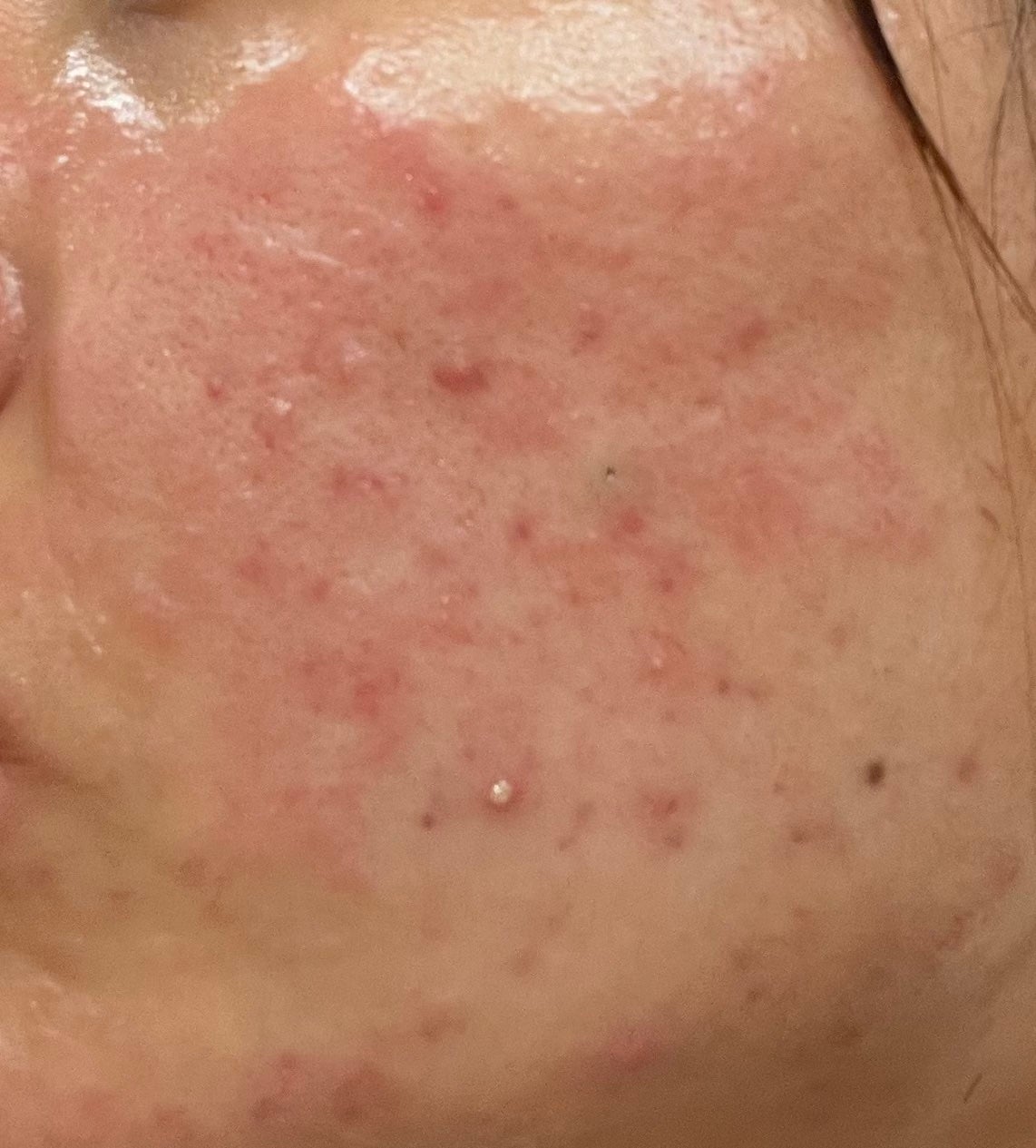 薬用ローション(とてもしっとり)/IHADA/化粧水を使ったクチコミ(1枚目)