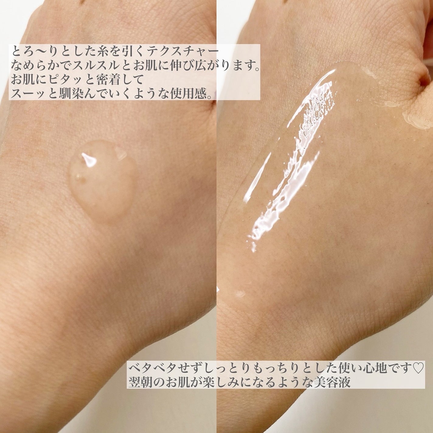 リマージ糸リフティングアンプル/REVENIP/美容液を使ったクチコミ(3枚目)