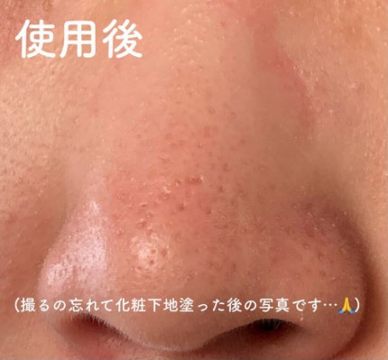 エマルジョンリムーバー 300ml/200ml/水橋保寿堂製薬/その他洗顔料を使ったクチコミ(4枚目)