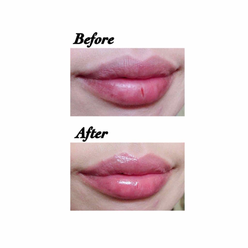 LIP8M/EsLucy/リッププランパーを使ったクチコミ（3枚目）