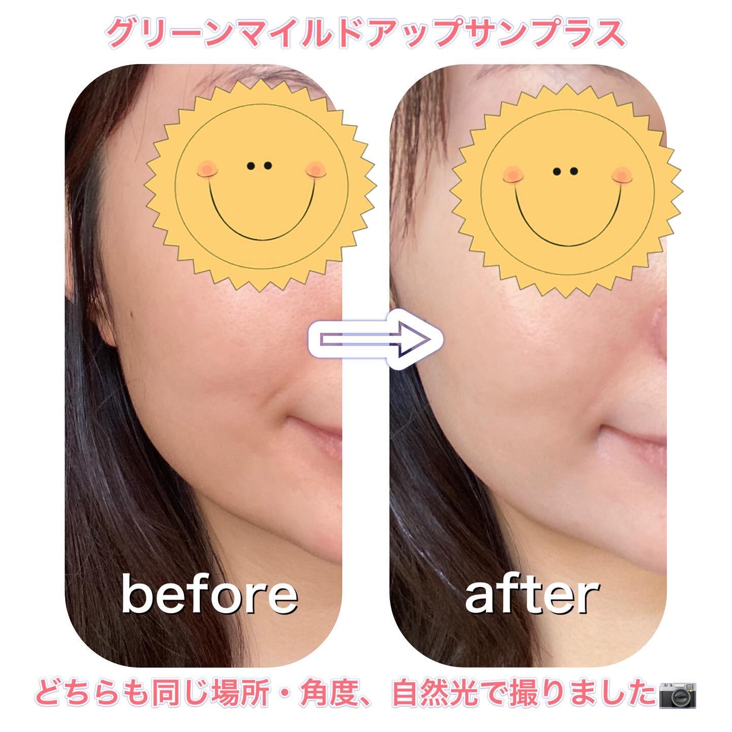 を使ったクチコミ（2枚目）