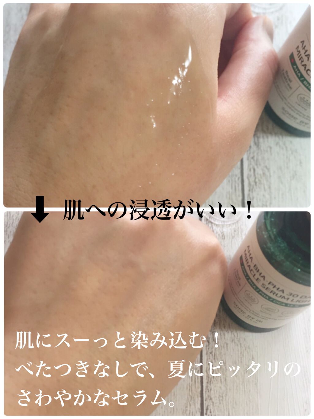 moai@美容ブロガー on LIPS 「こんにちは😃私のイチオシスキンケア、サムバイミー30デイズミラ..」(3枚目)