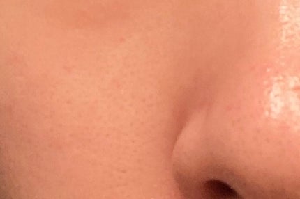 美容液 ノンアルコールタイプ/ちふれ/美容液を使ったクチコミ(2枚目)