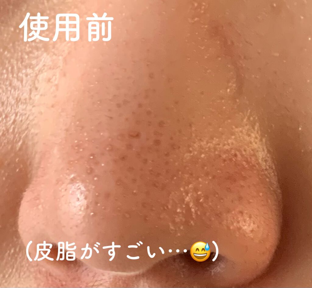 エマルジョンリムーバー 300ml/200ml/水橋保寿堂製薬/その他洗顔料を使ったクチコミ(3枚目)