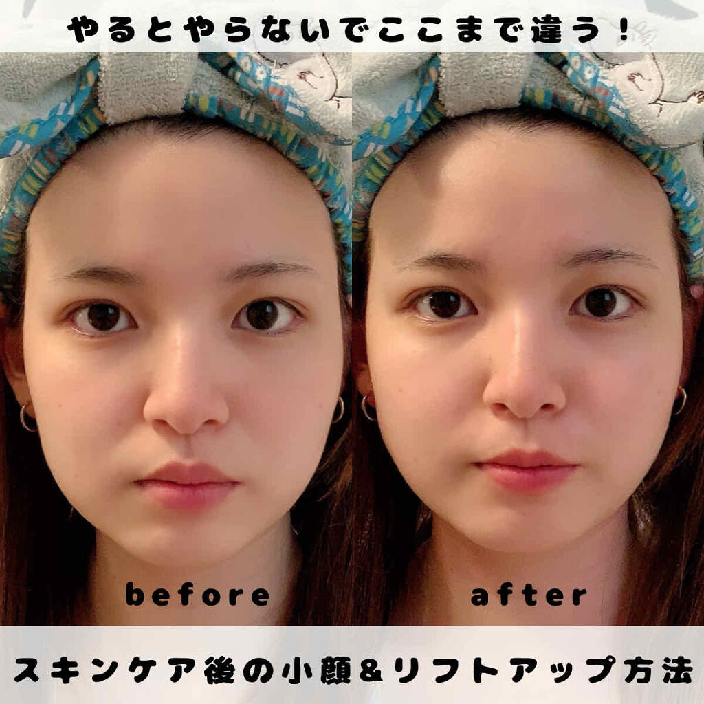 ハトムギ化粧水(ナチュリエ スキンコンディショナー R )/ナチュリエ/化粧水を使ったクチコミ（1枚目）