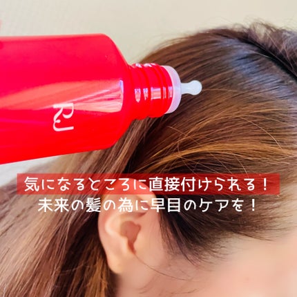 薬用 RJ地肌ケア エッセンス /アピセラピーコスメティクス/頭皮ローションを使ったクチコミ(3枚目)