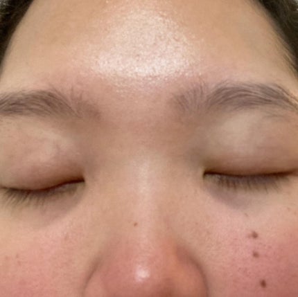 NAVIGATOR HA MICRO FILLER/TERISA/シートマスク・パックを使ったクチコミ(4枚目)