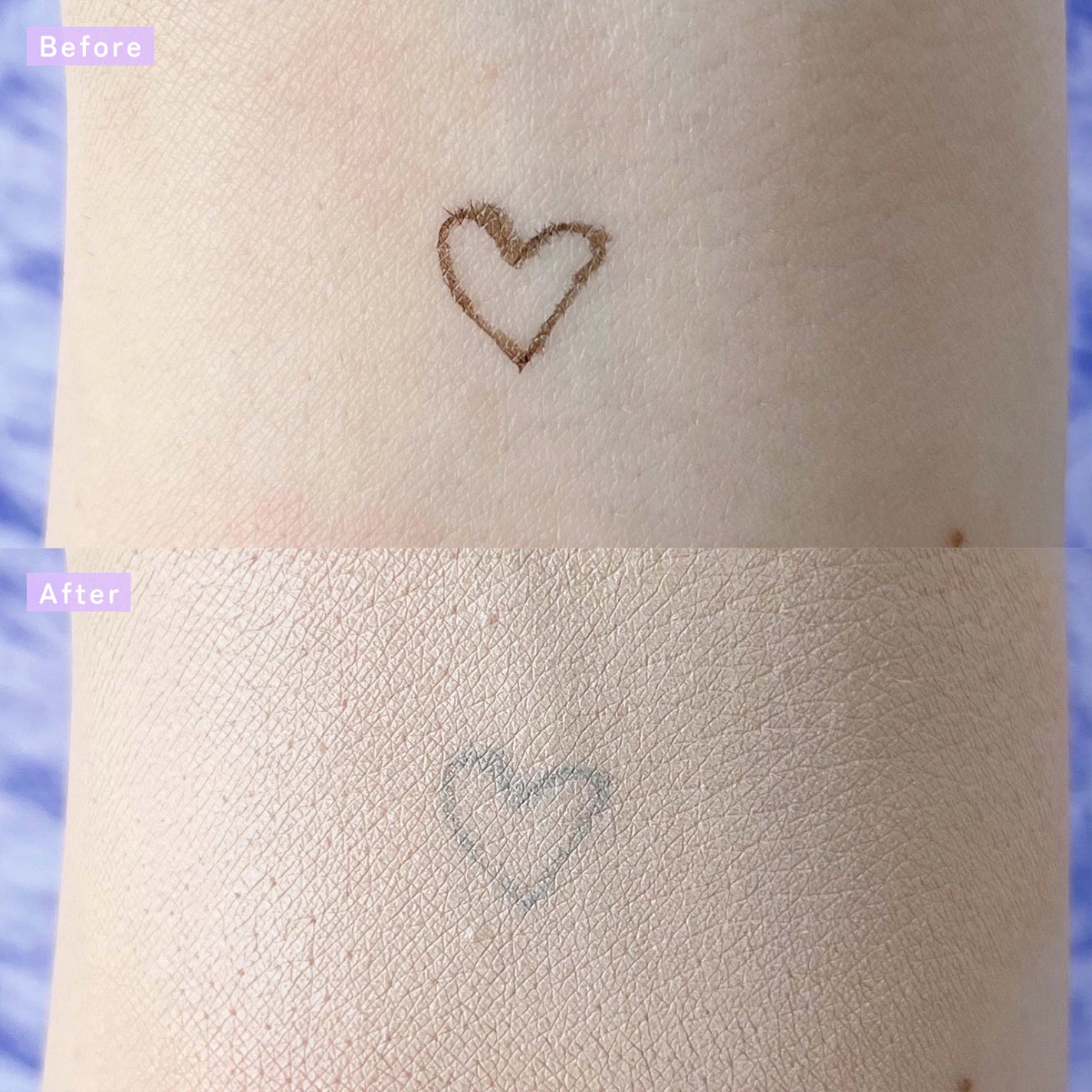 ピンクティーツリーカバーアップグロウクッション/APLIN/クッションファンデーションを使ったクチコミ(7枚目)