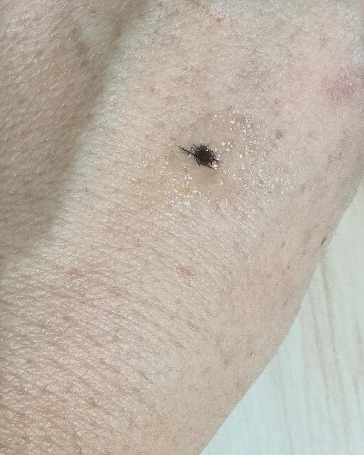 CICA method RECOVER PATCH/コジット/その他スキンケアを使ったクチコミ(5枚目)