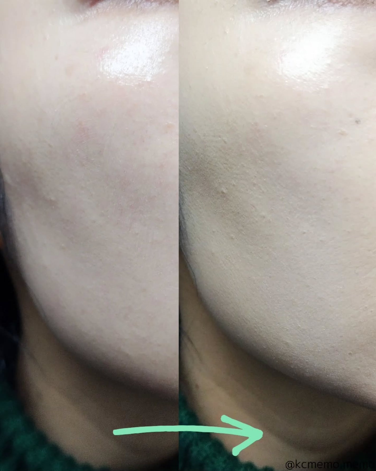 ハートリーフシーンカバークッション/23years old/クッションファンデーションを使ったクチコミ(5枚目)