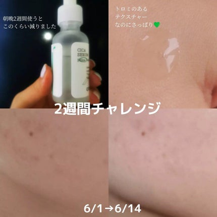 ピュアフィットシカセラム/COSRX/美容液を使ったクチコミ(2枚目)