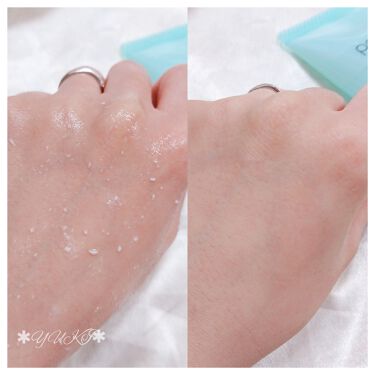 Pt 角質ピーリングジェル Ex ポアトルの口コミ Poretol By Yuki 代後半 Lips