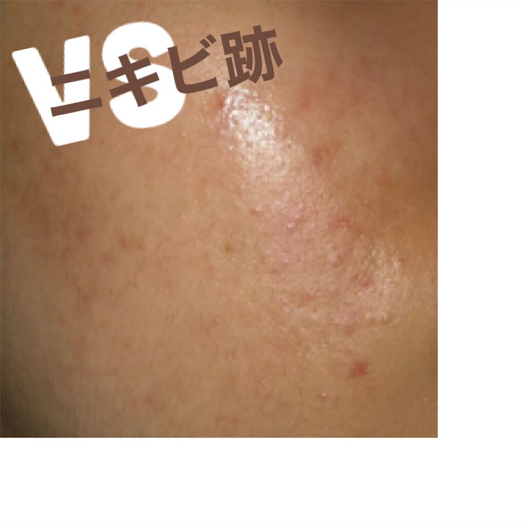 モイスチュアマイルドホワイト パーフェクトエッセンス/モイスチュアマイルド ホワイト/オールインワン化粧品を使ったクチコミ（1枚目）