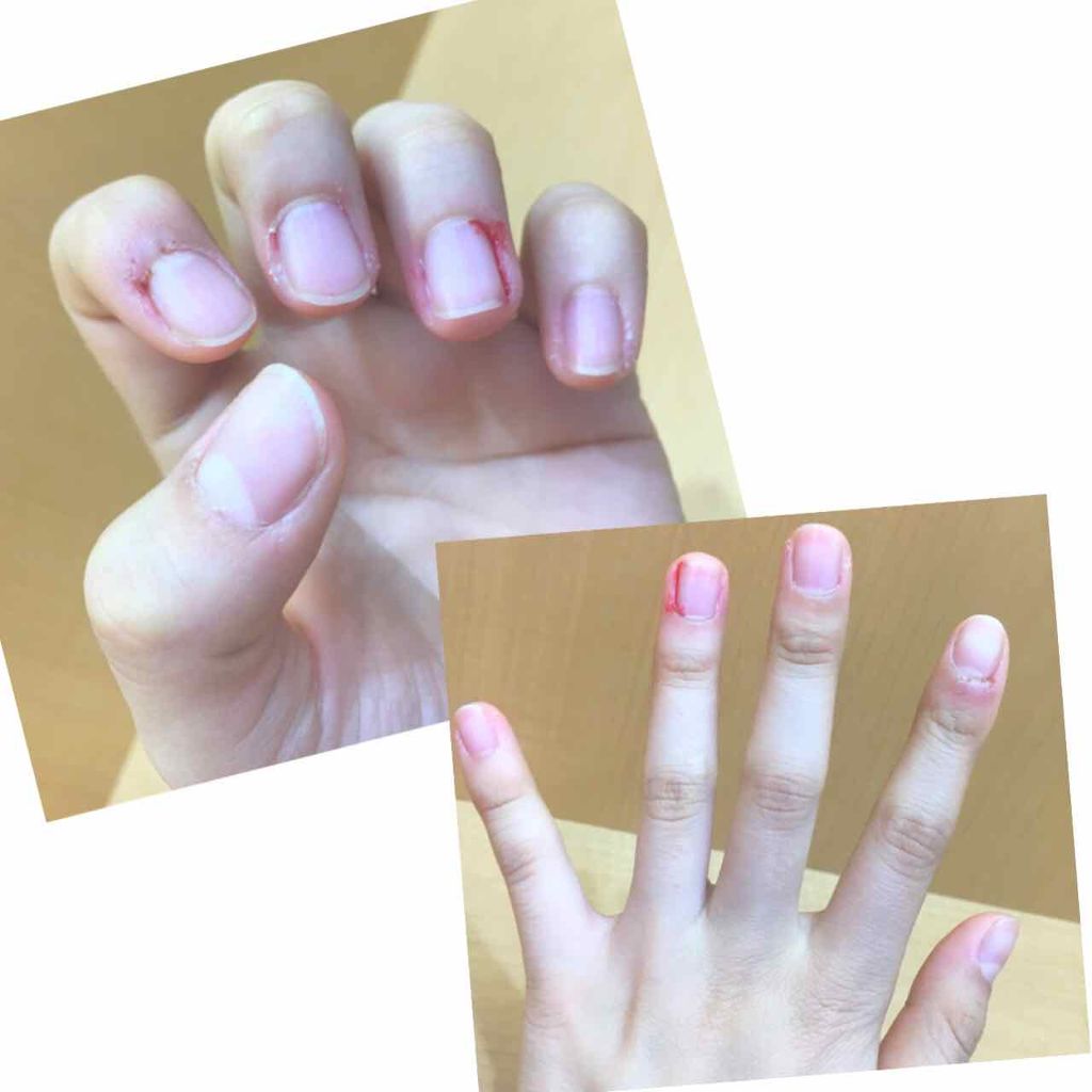 ニベアクリーム/ニベア/ボディクリームを使ったクチコミ(3枚目)