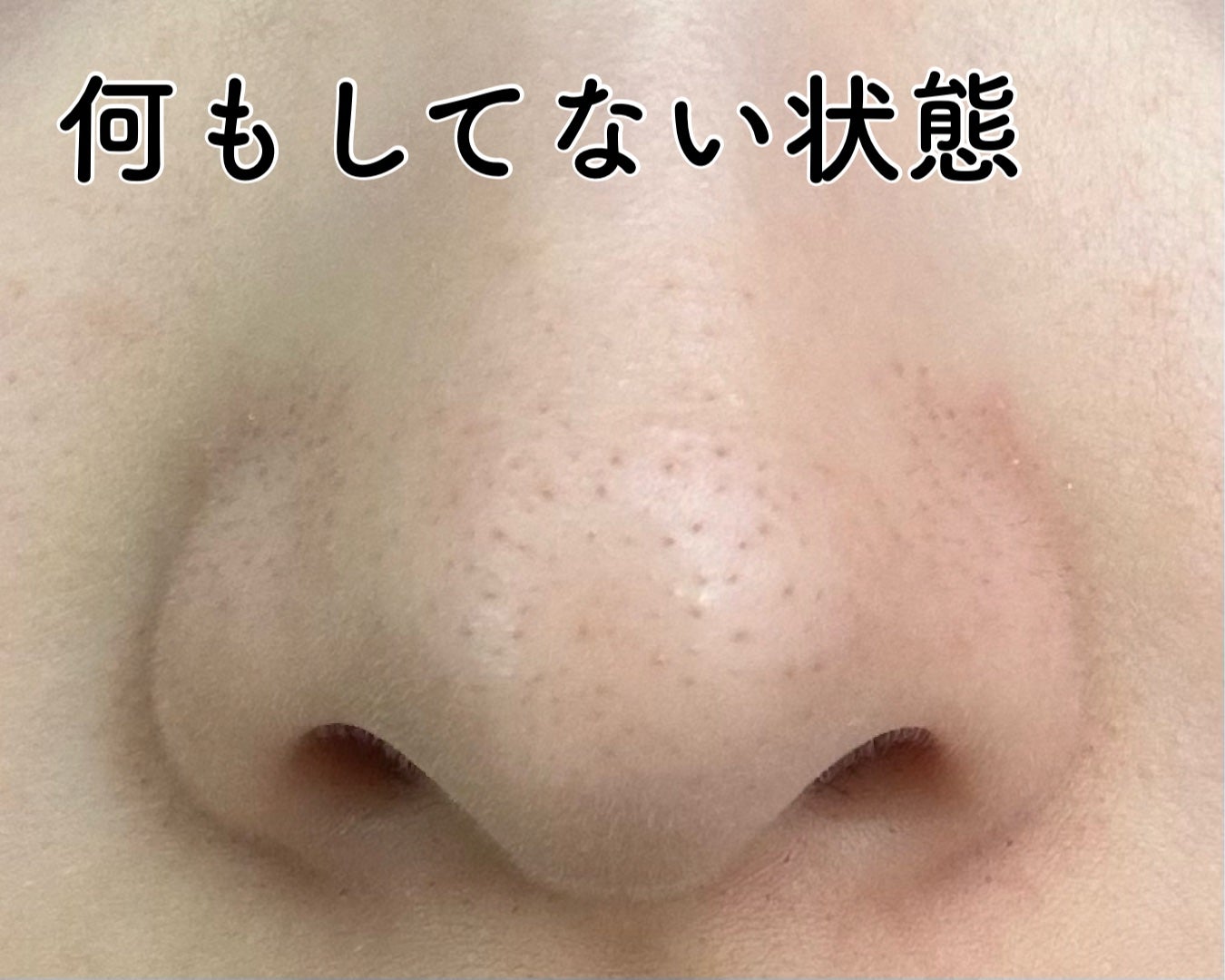 ノーモアブラックヘッド(ノーズピーリング)/One-day's you/スクラブ・ゴマージュを使ったクチコミ(2枚目)