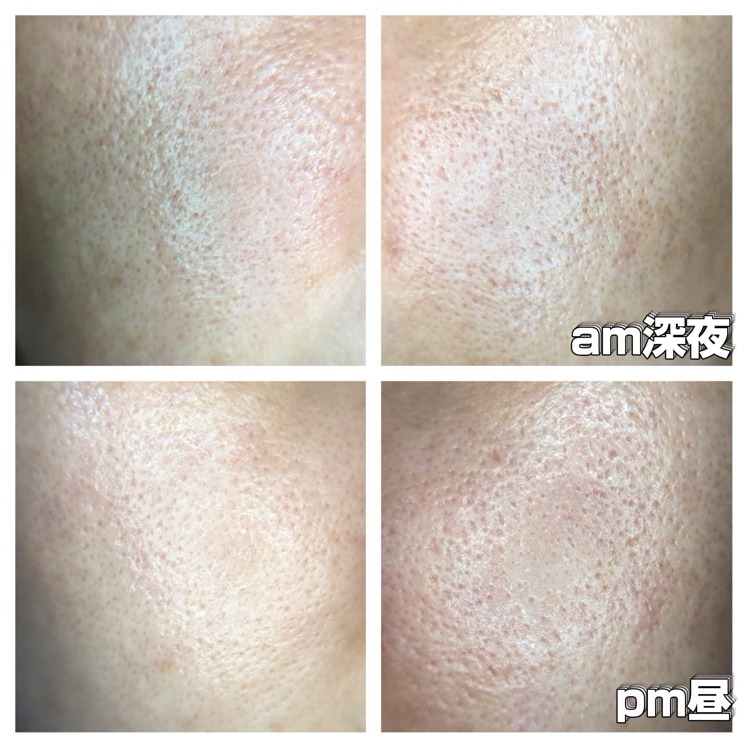 ヒートキャビシェイプ PRO/TBC/ボディケア美容家電を使ったクチコミ（2枚目）