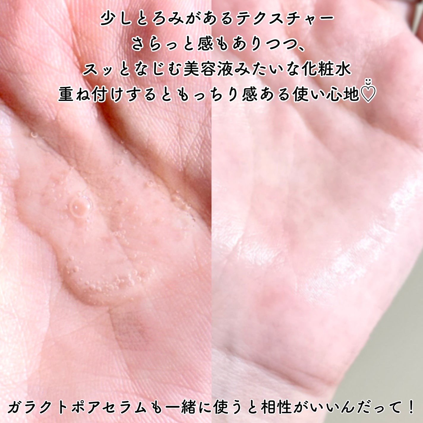 サミュ ガラクトポア セラム/SAM'U/美容液を使ったクチコミ(4枚目)