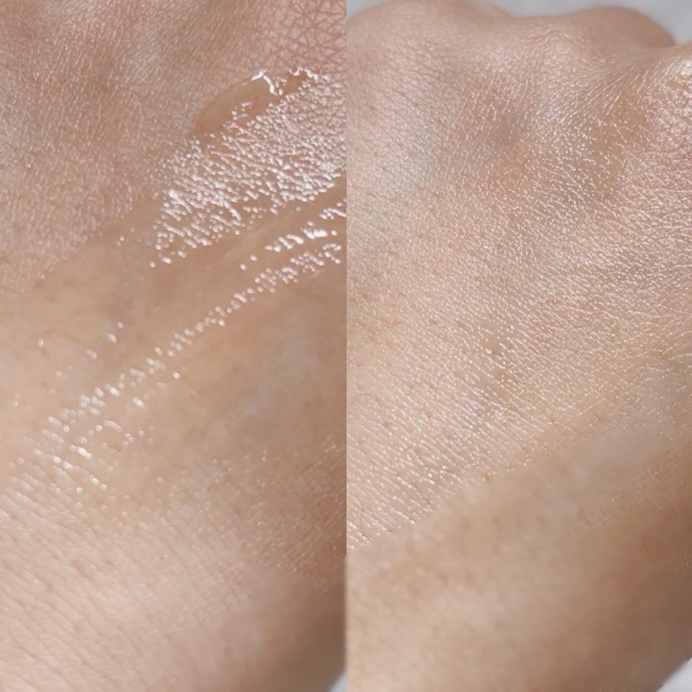 DW-EGFワンデイズアンプル/Easydew/美容液を使ったクチコミ(9枚目)