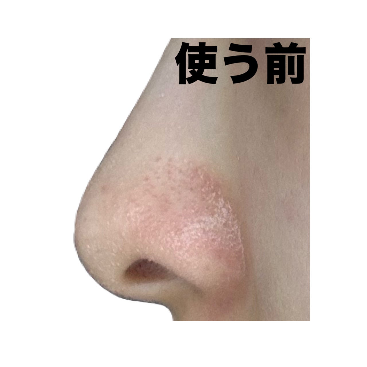 ノーズピーリングパック/One-day's you/シートマスク・パックを使ったクチコミ(4枚目)